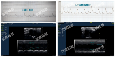 图2：空白组（左）；模型组（右，缺血再灌注）.png
