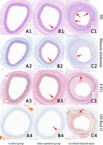 ffbc1b98056e491e10d7ca6928565f2e.png